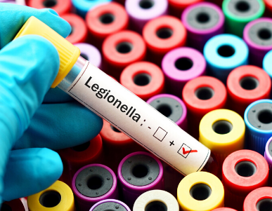 Voorkom Legionellabacteriën met de CSU Legionella Preventieservice_zorg plicht_samen slimmer_samen scherper