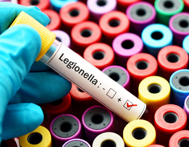 Voorkom Legionellabacteriën met de CSU Legionella Preventieservice zorg plicht samen slimmer samen scherper